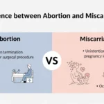 difference between abortion and miscarriage